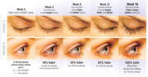 Latisse weeks
