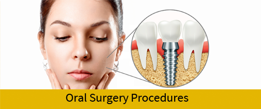 illustration of surgical procedures